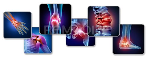 Nové aspekty terapie axiálních spondyloartritid bimekizumabem