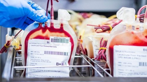 Kdy skutečně záleží na poměru 1 : 1? Výsledky analýzy téměř 5 000 traumatických pacientů