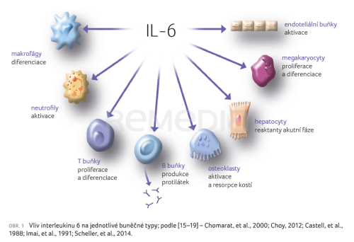 Kdy v praxi indikovat sarilumab?