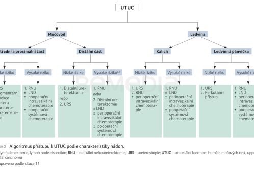 SCHÉMA 2 Algoritmus přístupu k&nbsp;UTUC podle&nbsp;charakteristiky nádoru