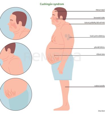 Zdroj: iStock